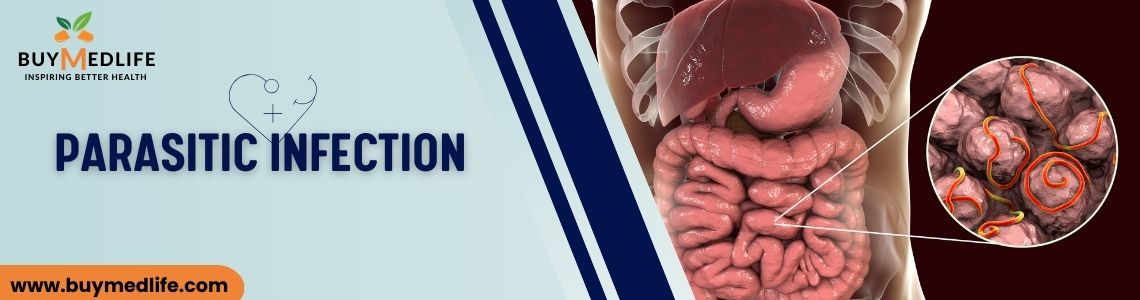 Parasitic Infections: Causes, Symptoms & Prevention