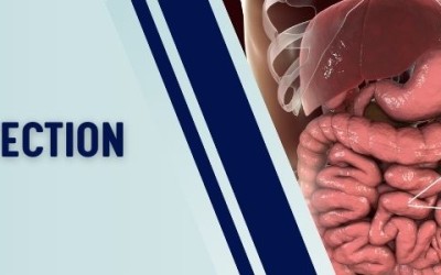 Parasitic Infections: Causes, Symptoms & Prevention