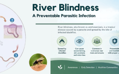 River Blindness: Causes, Symptoms, Treatment & Prevention