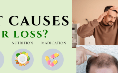 What Causes Hair Loss? Causes, Signs & Treatment Guide